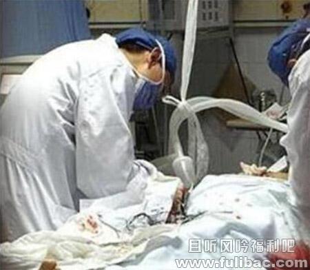 男子啪啪时下体着火烧伤 男子啪啪时下体着火烧伤