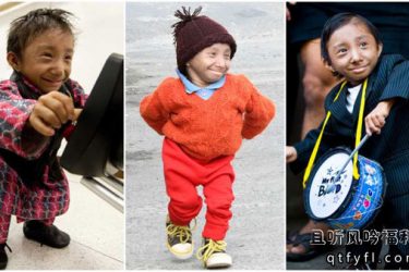 世界上最矮的人去世终年27岁 - 壹忧舍