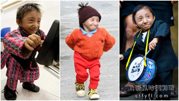 世界上最矮的人去世终年27岁 - 壹忧舍