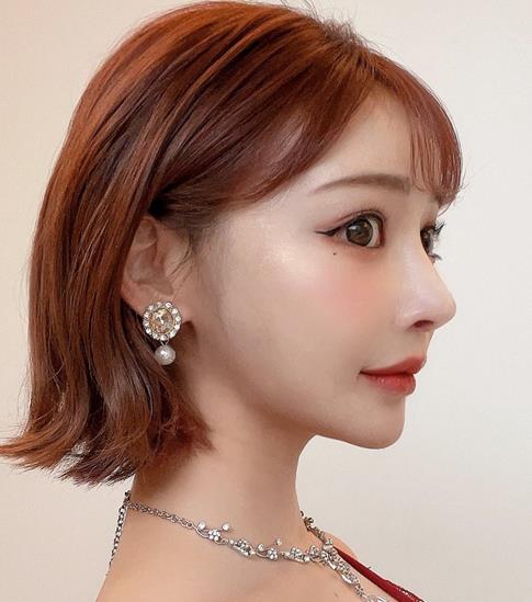 图片[3] - 明日花绮罗（明日花キララ）整形变美的代价？ - 壹忧舍