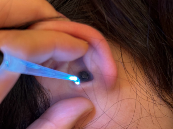 耳屎是如何产生的?耳屎要不要挖? - 壹忧舍