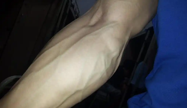 为什么有的人手臂青筋凸起，有人却看不见青筋？ - 壹忧舍