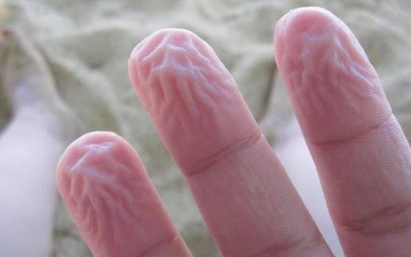 手指在水里泡久了,皮肤为什么会起皱 - 壹忧舍