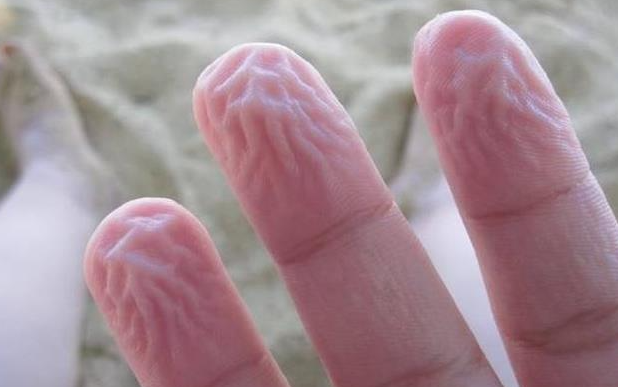 手指在水里泡久了，皮肤为什么会起皱 - 壹忧舍