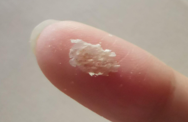 头皮上抠下来一块一块的是什么?能抠吗? - 壹忧舍