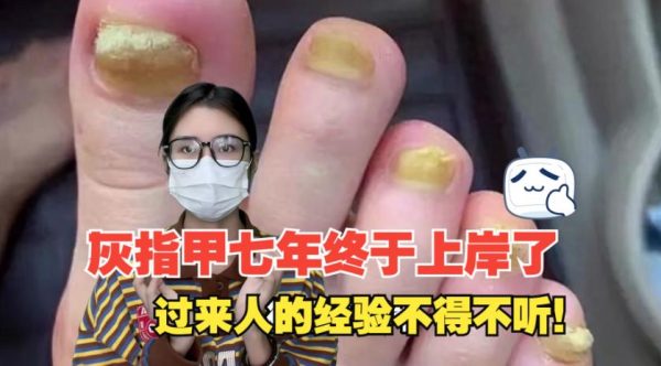 为什么人类会长灰指甲? - 壹忧舍