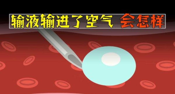 输液的时候,如果不小心输入了空气会怎样? - 壹忧舍