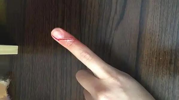 为什么手指被纸片割伤,比刀子划伤还要痛? - 壹忧舍